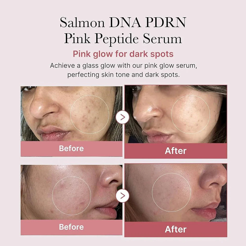 Radiant Skin Peptide Serum